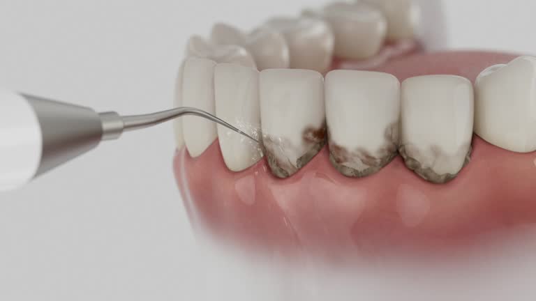 Reliable Dental Implants contractor in Greentown, IN by Smile Center Dentistry